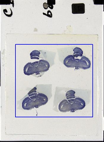 Media type: image; Special Collections 3298   shows specimen_part histological serial section;